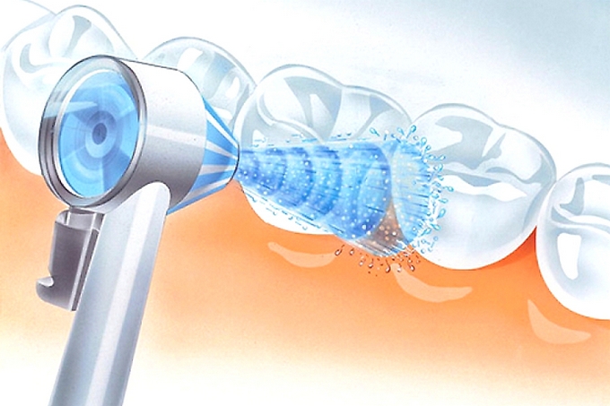 Air flow — эффективная система отчистки зубов