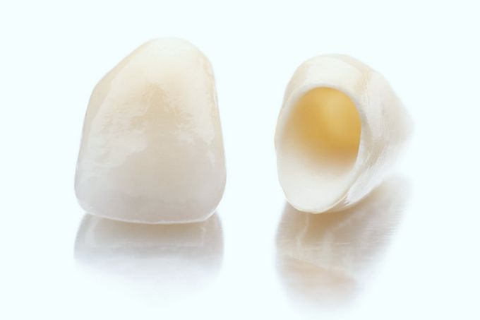 Качественные и долговечные зубные коронки